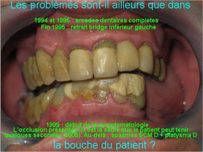 01 pb ailleurs s1upni - Eugenol