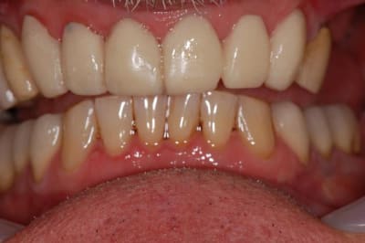 025 twzj6n - Eugenol