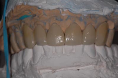 032 onkc05 - Eugenol