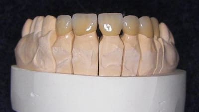 034c ciwjwo - Eugenol