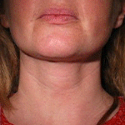 03 repos egurne - Eugenol