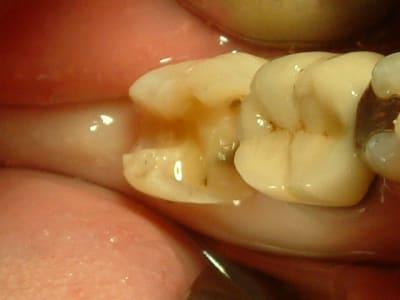 04051512 ugeolt - Eugenol