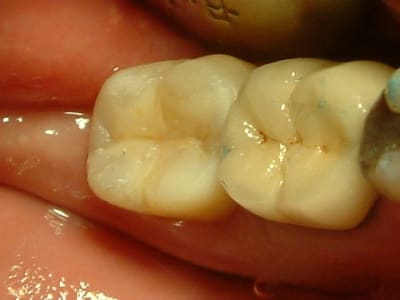 04051513 z7tjeb - Eugenol