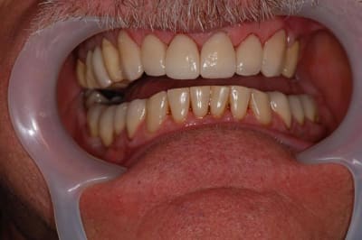 040 rsj1ov - Eugenol