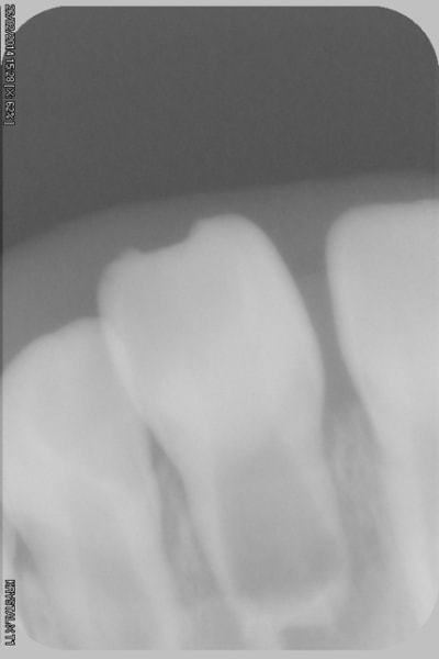 046 cbih4y - Eugenol
