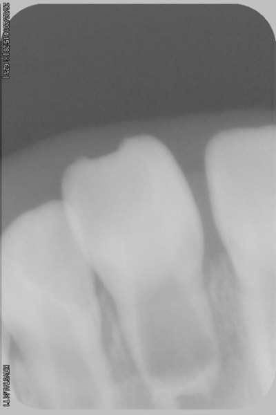 046 cbih4y - Eugenol