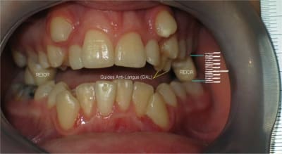 050712 dsd1 16a h0qcmr - Eugenol