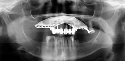 06 07 2015 jh60b6 - Eugenol