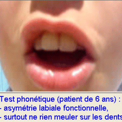 06 test phonetique bht8rm - Eugenol