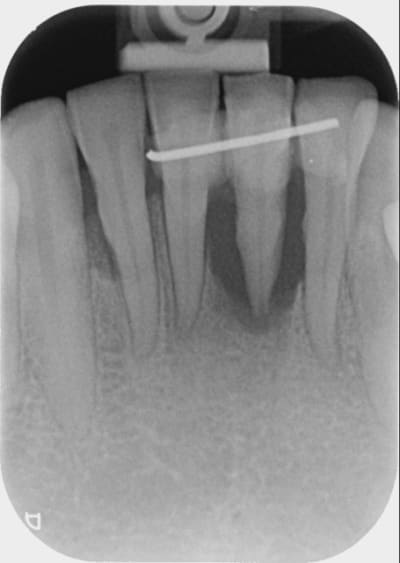 08115001 pymgf9 - Eugenol