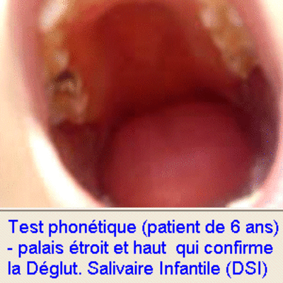 08 test phonetique ysrab9 - Eugenol
