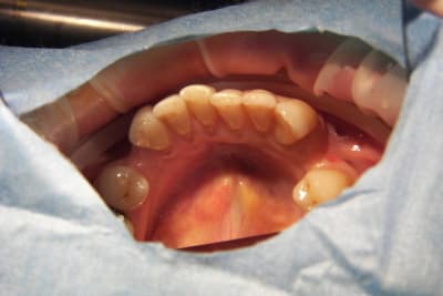 100 1080 ujzbtc - Eugenol