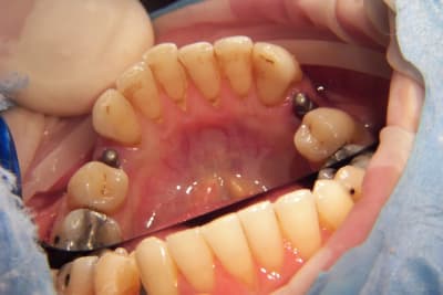 100 1108 qsn60a - Eugenol