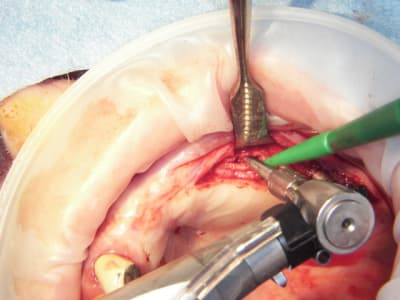 100 4573 oysxmy - Eugenol