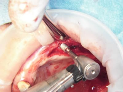 100 4620 da91tp - Eugenol