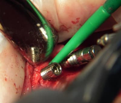 100 5370 yvrqm3 - Eugenol