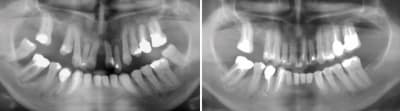10345 5 ans apr s la fin  qwcvxa - Eugenol
