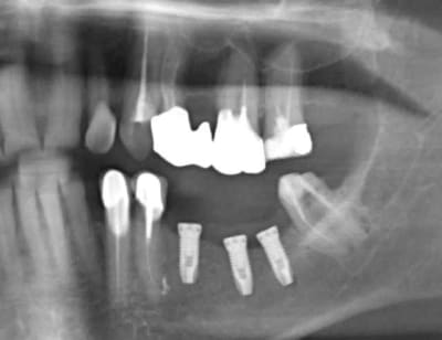 10 hr0uw4 - Eugenol