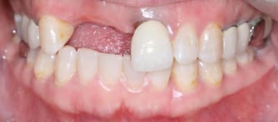 11 12 2 fnrxtz - Eugenol