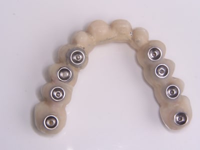 11 04 11 positdental 010 ksymwa - Eugenol