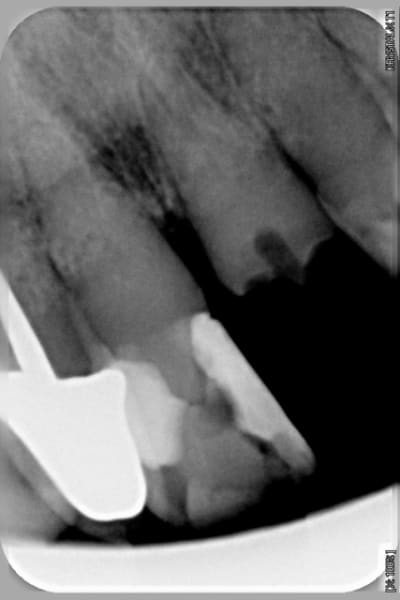 11 et 21 en 2009 xkfuim - Eugenol