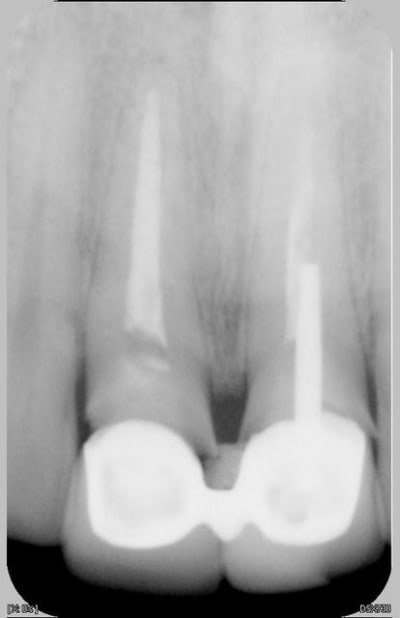 11 piston b1ihxm - Eugenol