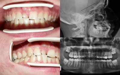 11bis xe5muc - Eugenol