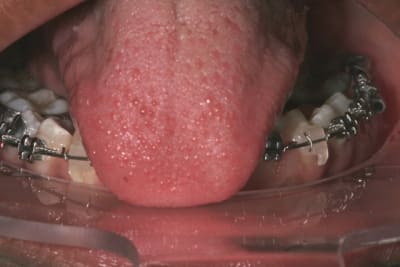 121 pg6eyp - Eugenol