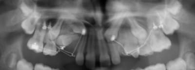 12224 1 i54xex - Eugenol