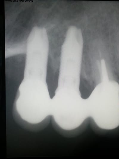 1234 u3qf5i - Eugenol