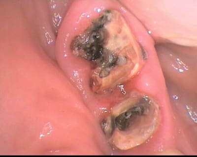 12 gjlpak - Eugenol