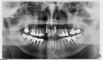 13022009 ci39xn - Eugenol