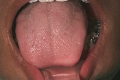 131 ckomz7 - Eugenol