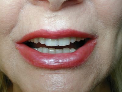 14090059 vjyfsb - Eugenol