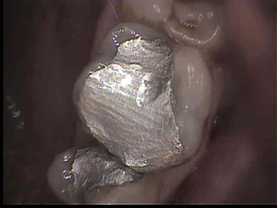 16 cam v9z2pz - Eugenol