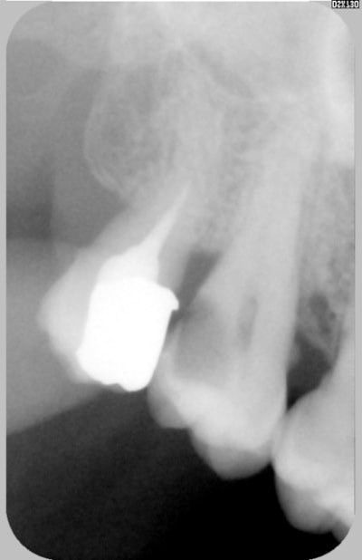 16 fpcdnp - Eugenol