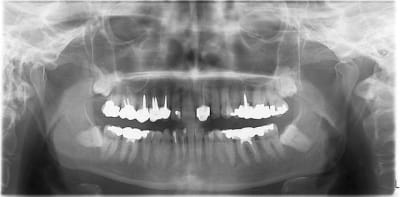 17542 qqquqn - Eugenol