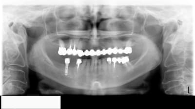 1798 kzg3vb - Eugenol