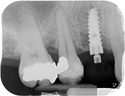 19751208 x 20150711 143835 x7uvjthxwyvb 4 xn9l4m - Eugenol