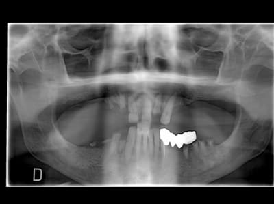 1 b 1  rjiyzg - Eugenol