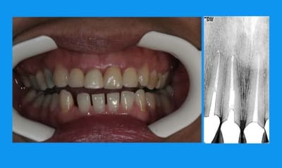 1  cons xwsgbr - Eugenol