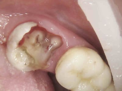 1 boeeho - Eugenol