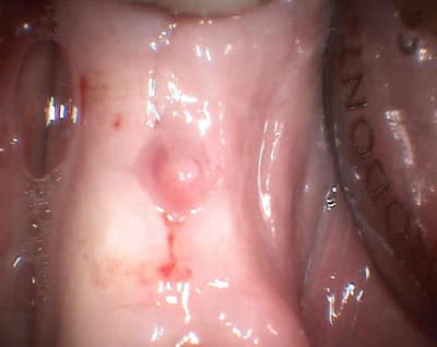 1 ncfxug - Eugenol