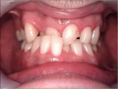 1 obir9o - Eugenol