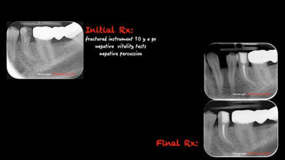 1 y6uqig - Eugenol