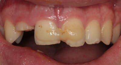1ere consult xbm9b2 - Eugenol