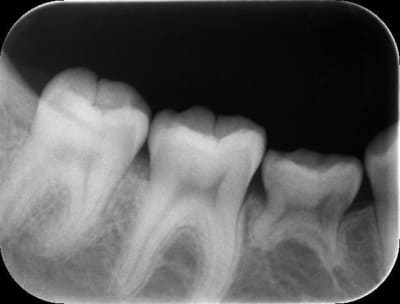 2005 lpd0kk - Eugenol