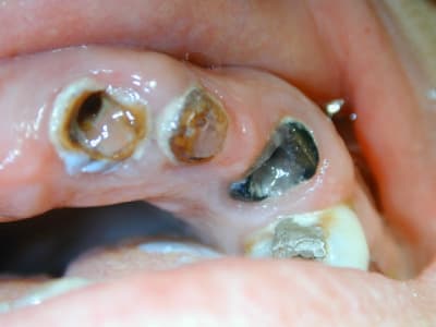 2009 11 26  2  bpvotq - Eugenol