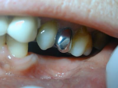 2009 11 27  3  crlrnf - Eugenol