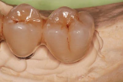 2010 11 04 177 fzb0hx - Eugenol